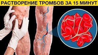 Эти 11 продуктов растворяют ТРОМБЫ в сосудах моментально. Как предотвратить образование тромбов?